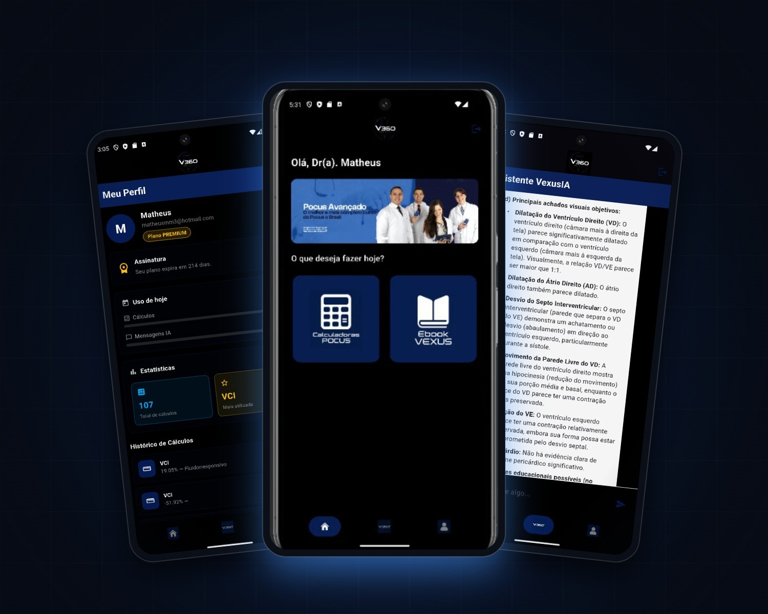 Telas do App V360 — início, calculadoras POCUS e assistente VexusIA