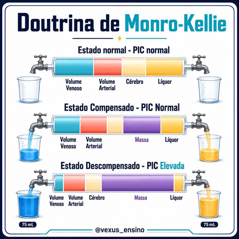 Doutrina de Monro-Kellie
