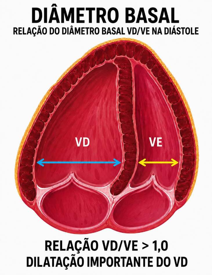Relação do diâmetro basal VD/VE na diástole