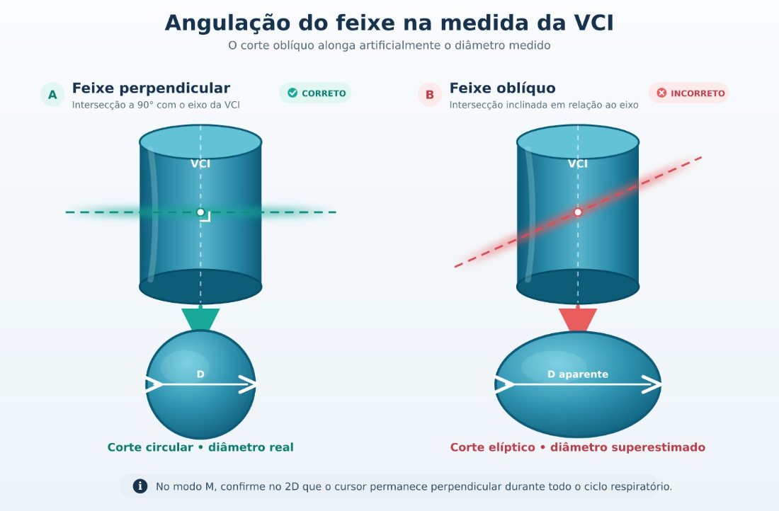 Angulação do feixe na medida da VCI