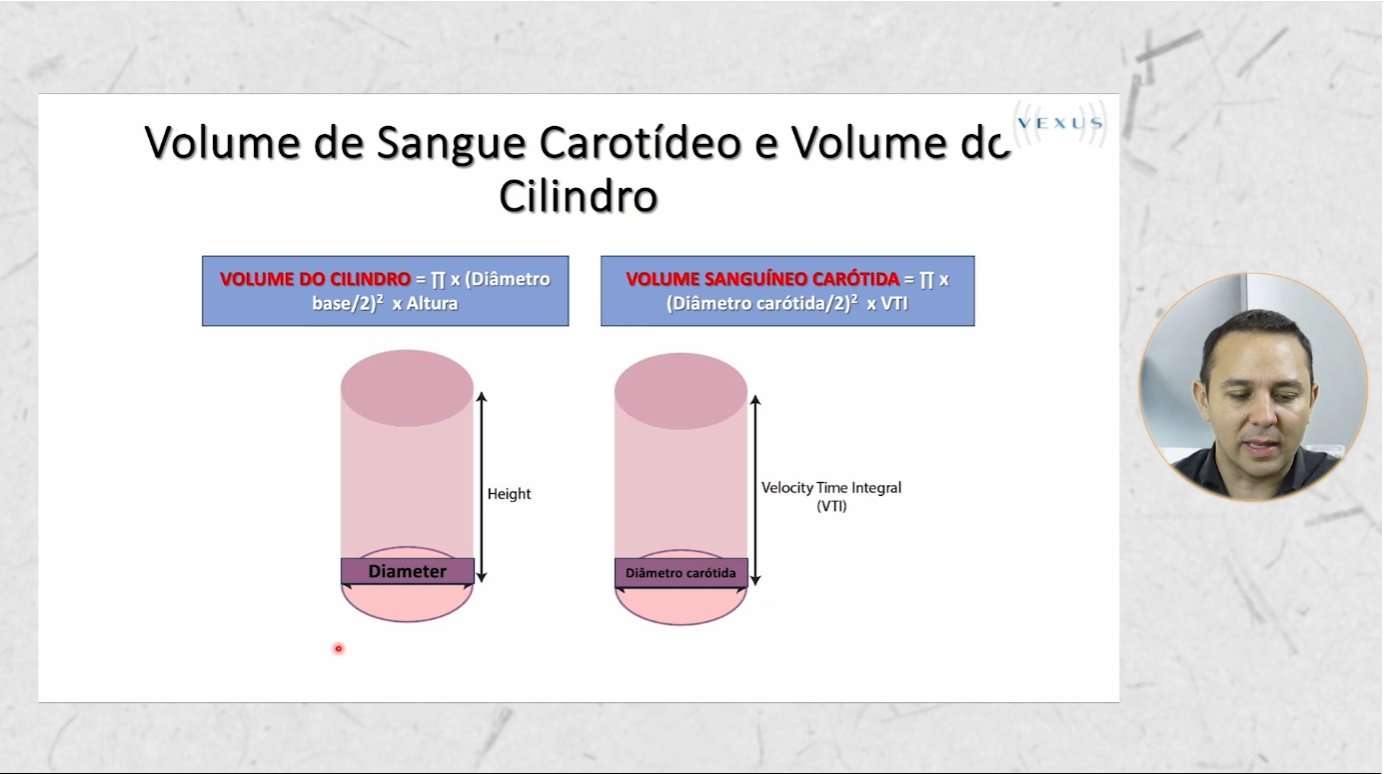 Videoaula de cálculo de débito cardíaco com VTI carotídeo