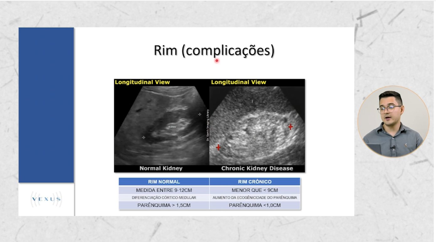 Videoaula de avaliação renal — rim normal × rim crônico