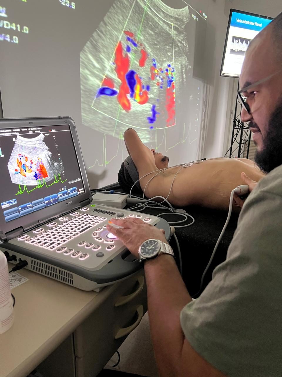 Doppler de veia interlobar renal projetado em tempo real